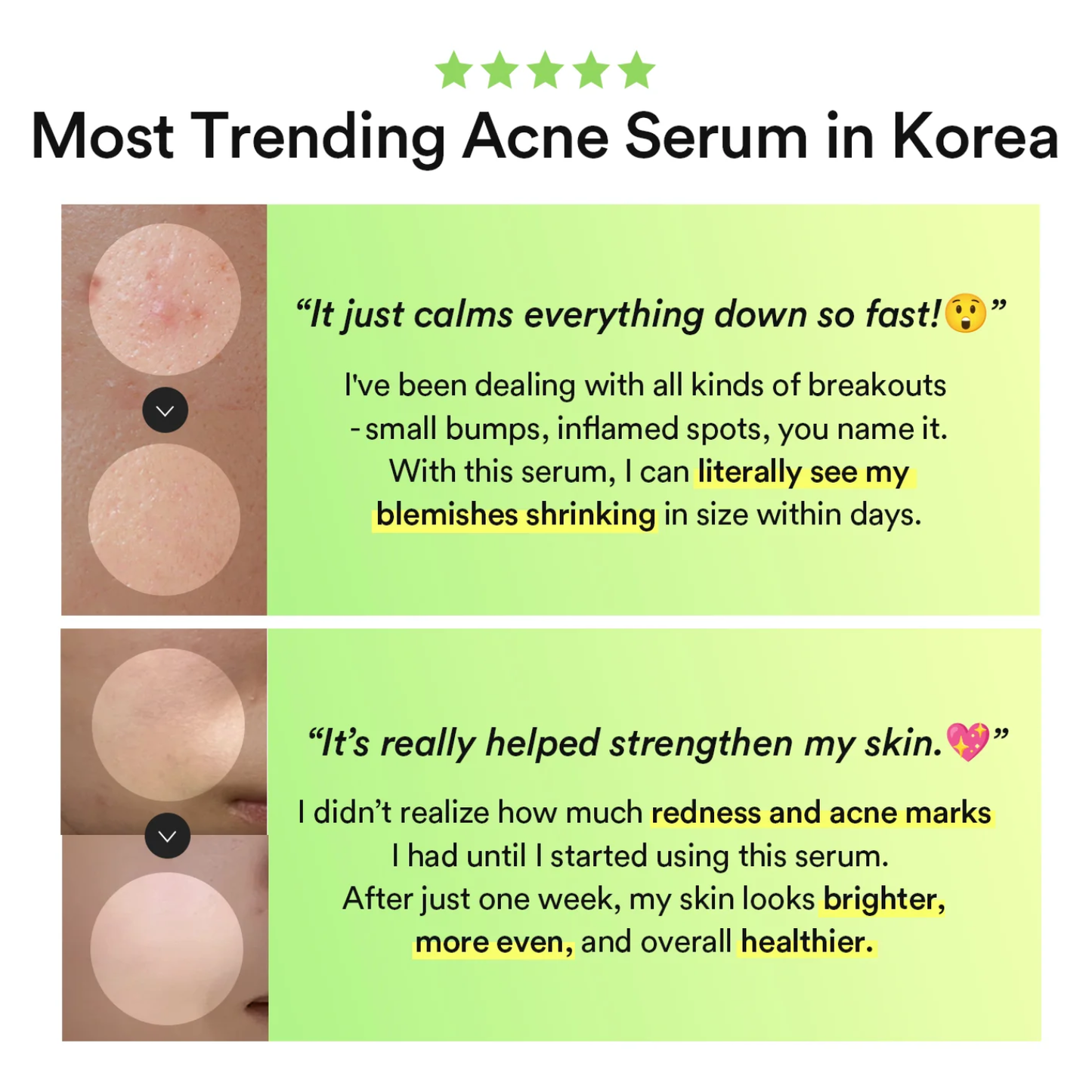 ABIB Heartleaf TECA Capsule Serum Calming Drop 50ml