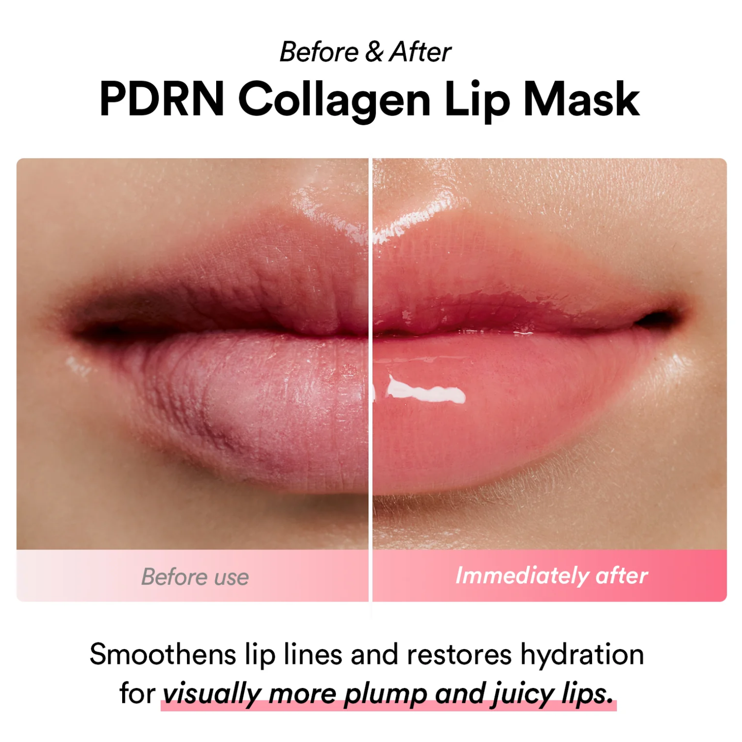 ABIB PDRN Collagen Lip Mask Glazed Jelly 11g